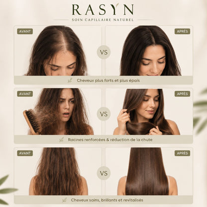 Protocole RASYN — Sérum Micro-Infusion Capillaire
