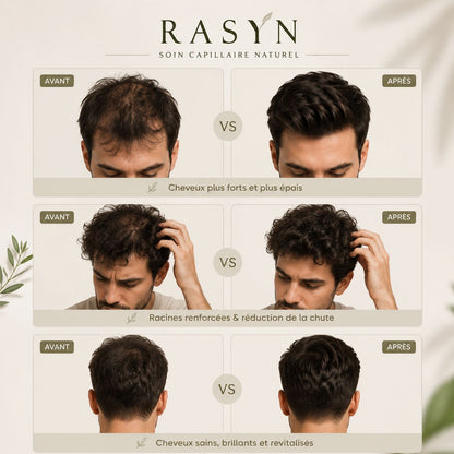 Protocole RASYN — Sérum Micro-Infusion Capillaire